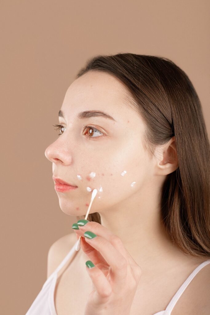 how to reduce inflammation on a pimple
